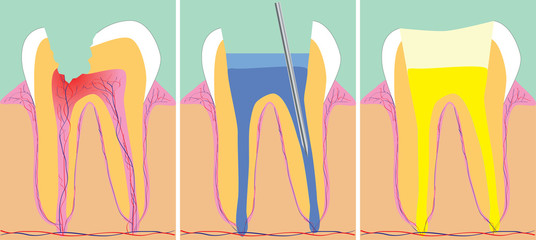 Three phase of dentistry, vector illustration