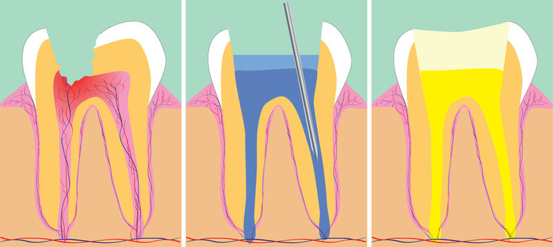 Three phase of dentistry, vector illustration