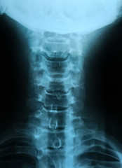human body's radiograph