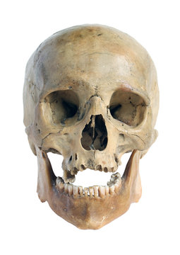 Skull of the person.