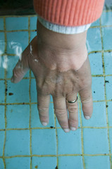 Hand mit Ehering, Frau, Seniorin, Wasserbecken, Osnabrücker Land