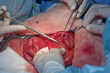 sutura  intestinale