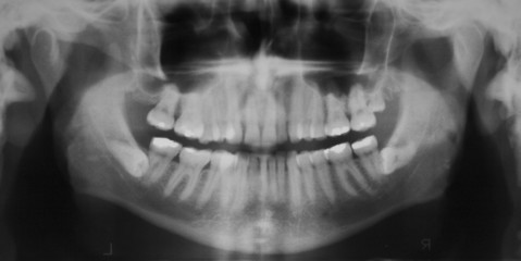 View of photos - dental x-ray