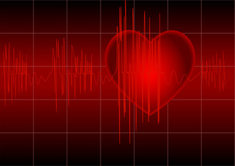 The cardiogram