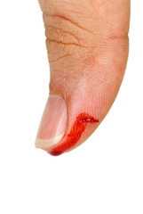 Bleeding thumb finger