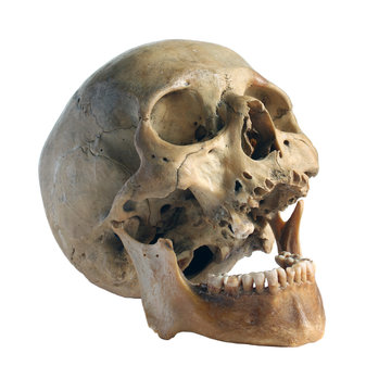 Skull of the person close-up.