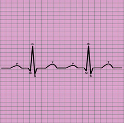 Naklejka premium normal ecg
