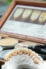 Dental Crown With Tools