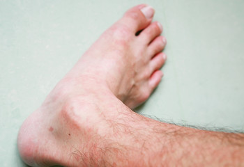Skin rash