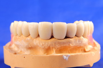 Dentaltechnik III