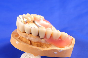 Dentaltechnik II