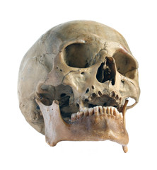 Skull of the person close-up.