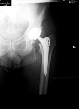 radiografia