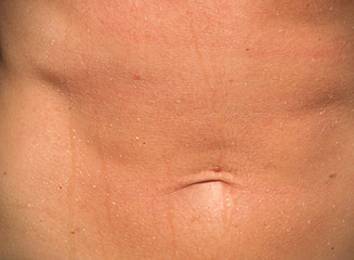 Fototapeta premium human skin