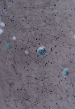 Aspergillus Mold