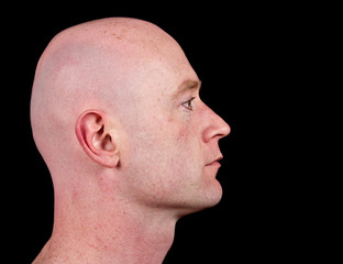 close up picture of a male head from side on black