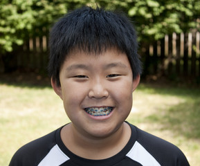 Young Korean boy smiling and showing his braces