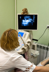 Obraz na płótnie Canvas Położnik rozpatrywania ciąży brzuch przez skanowanie ultrad¼więkowej.