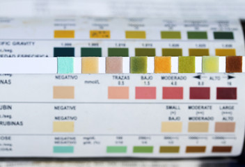 Urine multi test