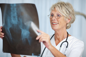 ältere ärztin mit röntgenbild