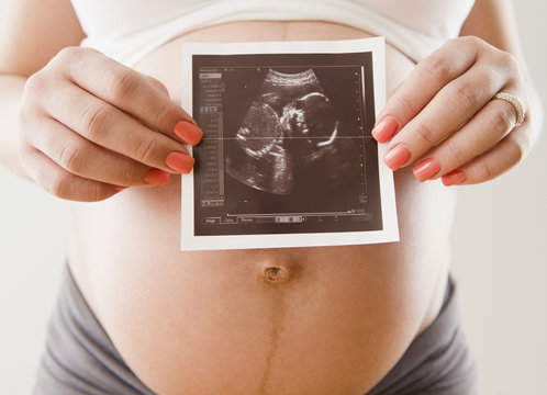 Pregnant Hispanic woman holding sonogram picture