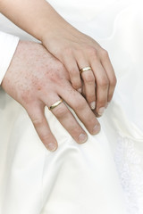 Dłonie młodego małżeństwa z obrączkami