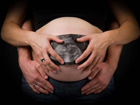 Ultraschallbild vor schwangerer Frau / Paar