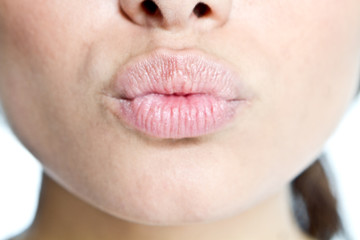 kiss