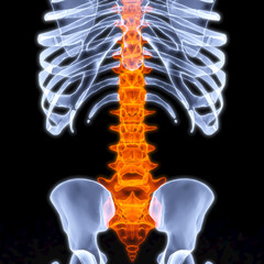 skeleton