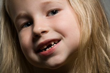 little girl without a front tooth