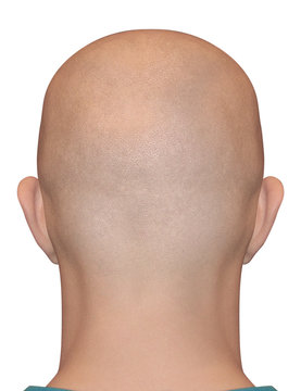 Bald Head Man. Smooth Shaved Nape Isolated On White Background. Alopecia Illustration