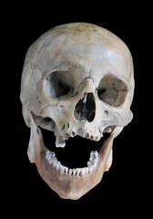 Skull of the person.