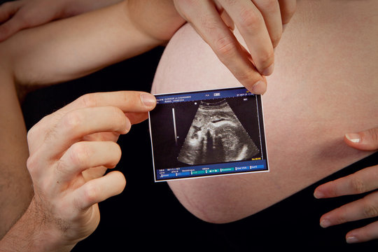 Echographie de grossesse