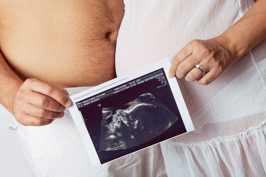 1 Best Echographie Images Stock Photos Vectors Adobe Stock