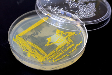 Micrococcus luteus © erbephoto