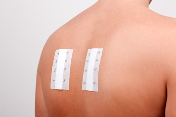 allergie test