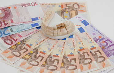 Zahnersatz kostet Geld