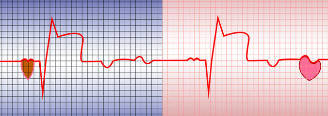 Heart ECG