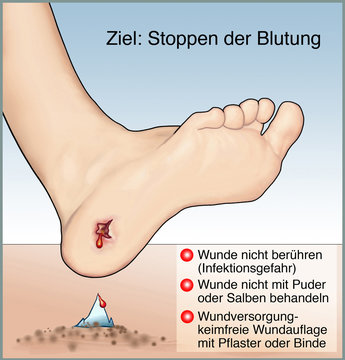 Blutungen allgemein. Erste Hilfe bei Wundversorgung