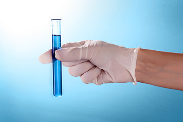 Test tube with liquid in the doctor's hand on the blue backgroun