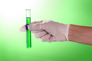 Test tube with liquid in the doctor's hand on the green backgrou