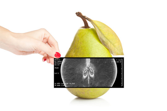 Female doctor holding an x-ray revealing inner view of a pear