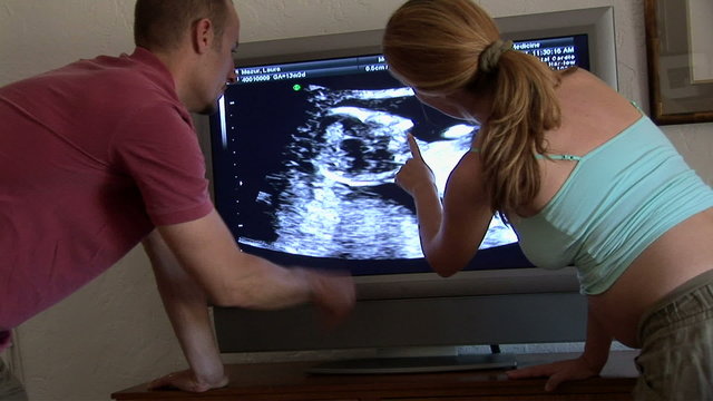 Pregnant couple watching ultrasound