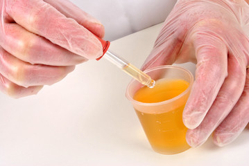 Pipette neben Messbecher mit Flüssigkeit