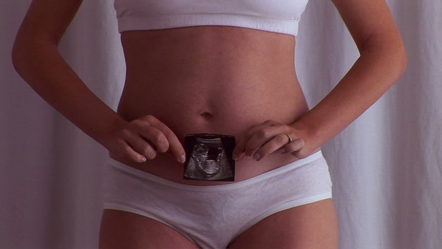 Pregnant woman with picture of an ultrasound image