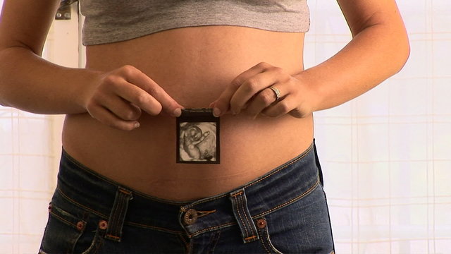 Pregnant woman with picture of an ultrasound image