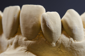 plaster, protruding tooth