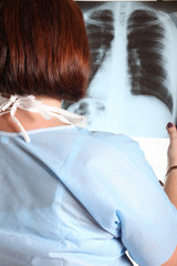 Donna medico osserva una radiografia