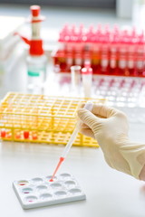 Medizin Gen Probe Doping Labor