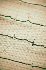 Cardiogram